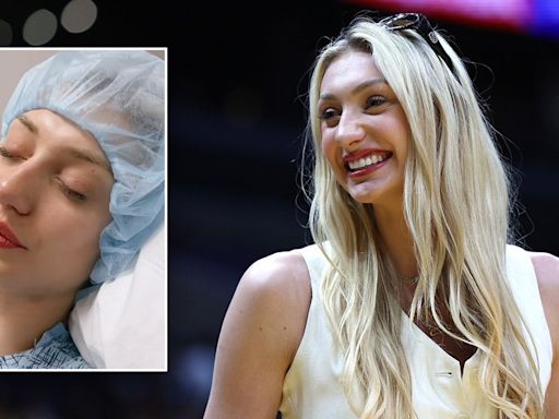 WNBA rookie Cameron Brink responds to fans saying she wore makeup post-ACL surgery