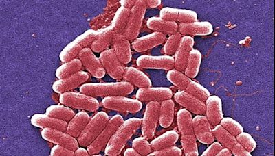 Urgent E coli health warning as more than 100 cases linked to ‘nationally distributed’ food