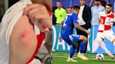 Eurocopa 2024 - Aficionado croata sufrió brutal ataque de una mujer dentro del estadio por una camiseta de la Selección de Croacia