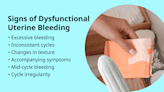 What’s Considered Dysfunctional Uterine Bleeding?