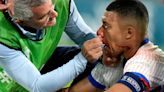 Ex-boxer who broke nose 15 TIMES fires warning to Mbappe after horror injury