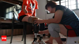 Malaysian beautician loses all limbs after this bacterial infection - Times of India