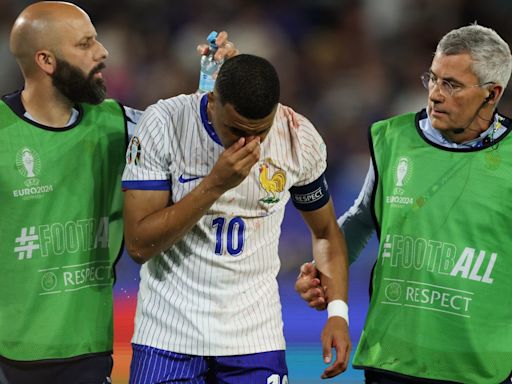 Mbappé tendrá que operarse ahora o después de la Eurocopa