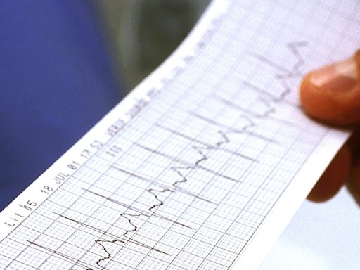 Iowa woman claims her heart monitor produced data from another patient
