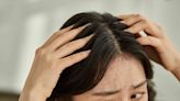 How to Treat an Itchy Scalp, According to Experts