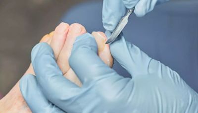 Plastic Surgery Day 2024: How To Choose The Right Specialist For The Treatment Of Your Diabetic Foot