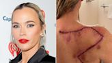 Teddi Mellencamp Arroyave Reveals Large Scar Following Surgery to Remove Melanoma