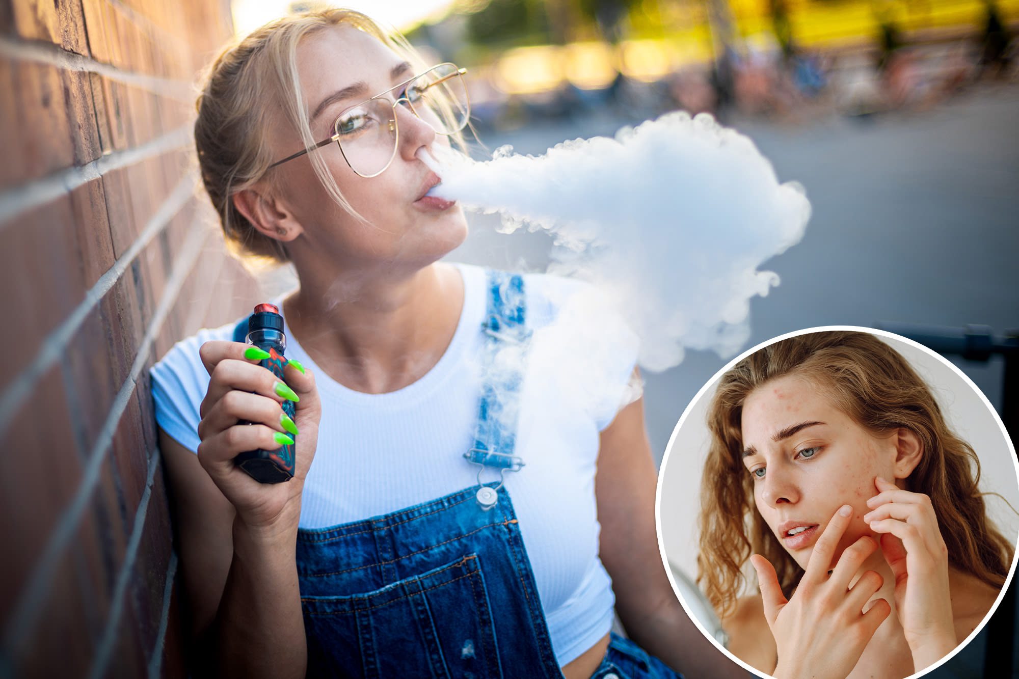 Gen Z’s love for vaping could be the reason they’re ‘aging like milk’: docs