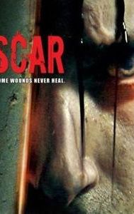 Scar