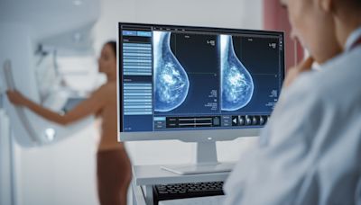 Qatar adopts Lunit’s AI technology for national breast cancer screening