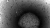 CDC detecta 2 cepas de viruela símica en EEUU