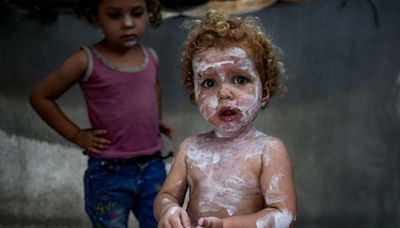 Piojos, sarna y erupciones cutáneas plagan a los niños palestinos en los campamentos de Gaza