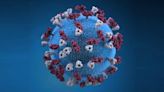 Measles in Northern California: How contagious is the virus? What are the symptoms?
