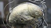 Non-invasive deep brain stimulation ‘could provide treatment for brain diseases’