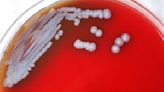 CDC, for first time from samples taken in U.S., discovers bacteria that causes rare serious disease