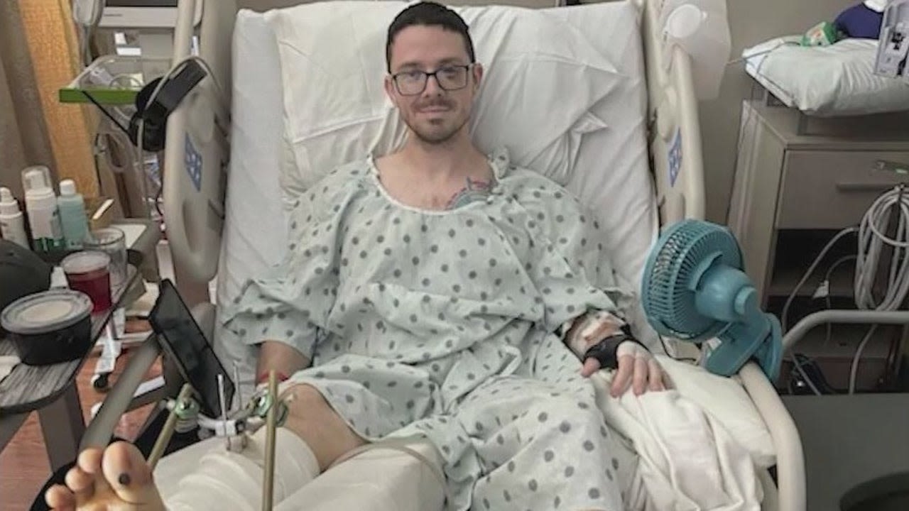 West Melbourne hit-and-run survivor still hospitalized, could lose part of leg: 'Hard to process'