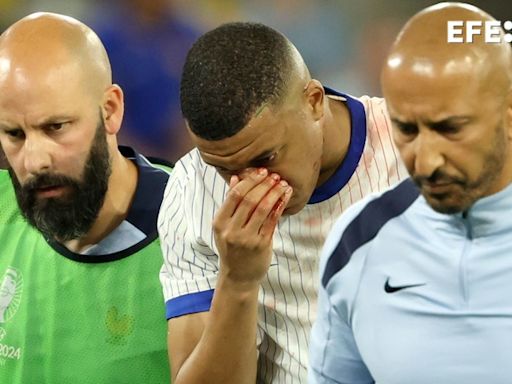 Mbappé se fractura la nariz, regresa a la concentración y jugará con máscara