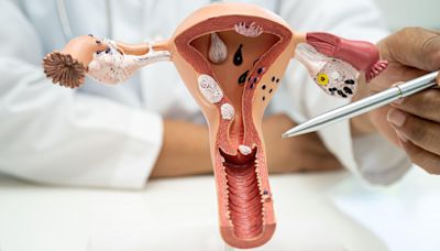 DIY kits may see million more cervical-cancer tests