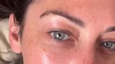 I'm 36 and banished all my eye wrinkles in just a month using an Amazon buy