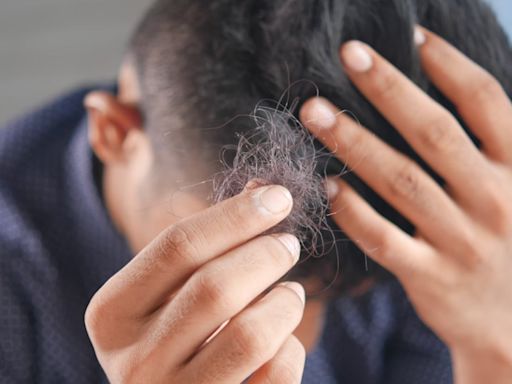 Biotina para el pelo: así puedes tratar la caída del cabello