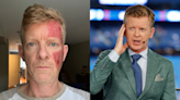Blue Jays host Jamie Campbell says he's in treatment for 'pre-skin cancer' — what does that mean?