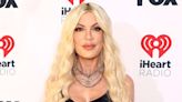 Tori Spelling Opens Up Her 'Disgusting' Teeth Before Getting Veneers: 'I Couldn’t Smile Anymore'