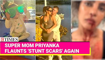 Priyanka Fights Filming Injuries with Malti's Cuddles &...Garlic?! Desi Girl's 'Nuskha' for Healing | Etimes - Times of India Videos