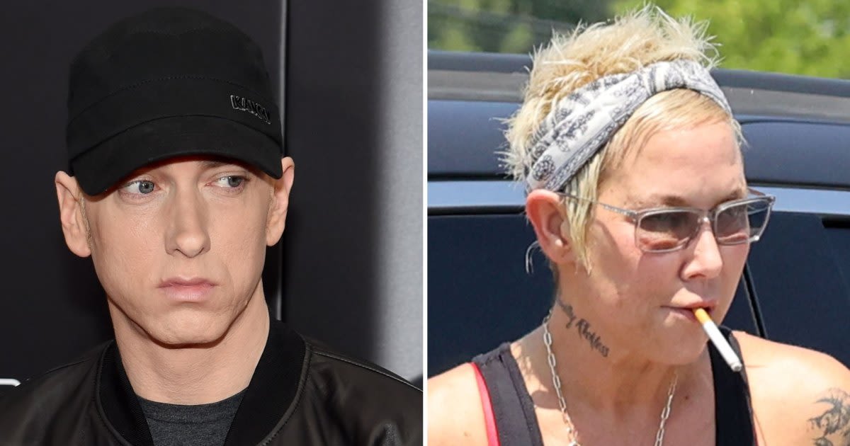 Eminem's Ex Kim Mathers Seen With Apparent Injury in Rare Outing