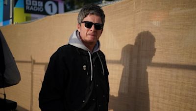 Noel Gallagher reveals frustration as he's set to 'undergo surgery'