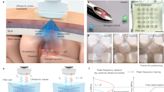 Smart hydrogel injected into intracranial fluid can measure changes in temperature, pH or pressure