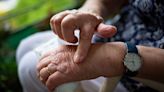 JAK inhibitors effective for treating arthritis, study confirms
