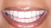 Big event coming up? Brighten your smile with these No. 1 bestselling Crest Whitestrips, on sale for $25