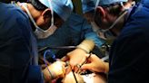 Heart surgery breakthrough 'could help millions of people'