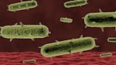 Case of human plague confirmed in Colorado