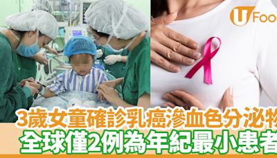 乳癌｜3歲女童確診乳腺癌滲血色分泌物 全球僅2例為年紀最小患者 | U Food 香港餐廳及飲食資訊優惠網站