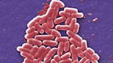 Death in Scotland attributed to E. coli outbreak