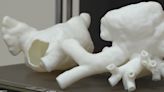 How 3D printers help aide medical teams in complex procedures