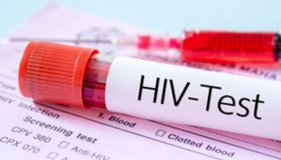 Experimental cancer drug may help clear HIV from brain cells