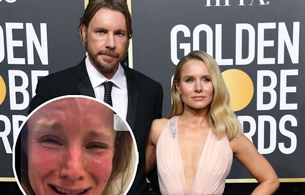 Dax Shepard Shares Video of Kristen Bell 'Gassed' On Nitrous at Dermatologist