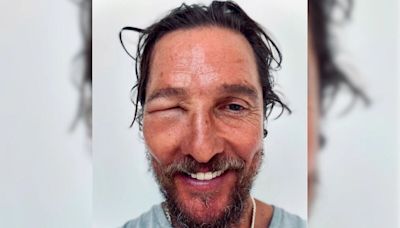 Matthew McConaughey Posted This "Bee Swell" Pic. "I've Been There," Commented Bear Grylls