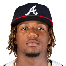 Ronald Acuna Jr. limps off the field Sunday