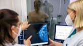 “Parece una paradoja”: por qué la doble mastectomía no mejora la supervivencia del cáncer de mama, según un estudio - La Tercera