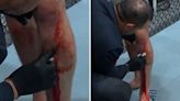 UFC fight stopped after horror cut 'like a bullet wound' caused pool of blood