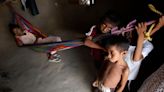 Desnutrición en Colombia: hay 254 casos en menores de cinco años en Santander en lo corrido del 2024