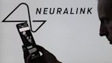 Neuralink Wants to Expand Brain Chip Trial to Second Human Patient