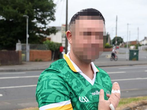 Councillor claims ‘fear factor’ in town where Catholic man attacked for wearing GAA jersey