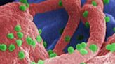 UN urges Gilead to 'make history' with game-changing HIV drug - ET HealthWorld | Pharma