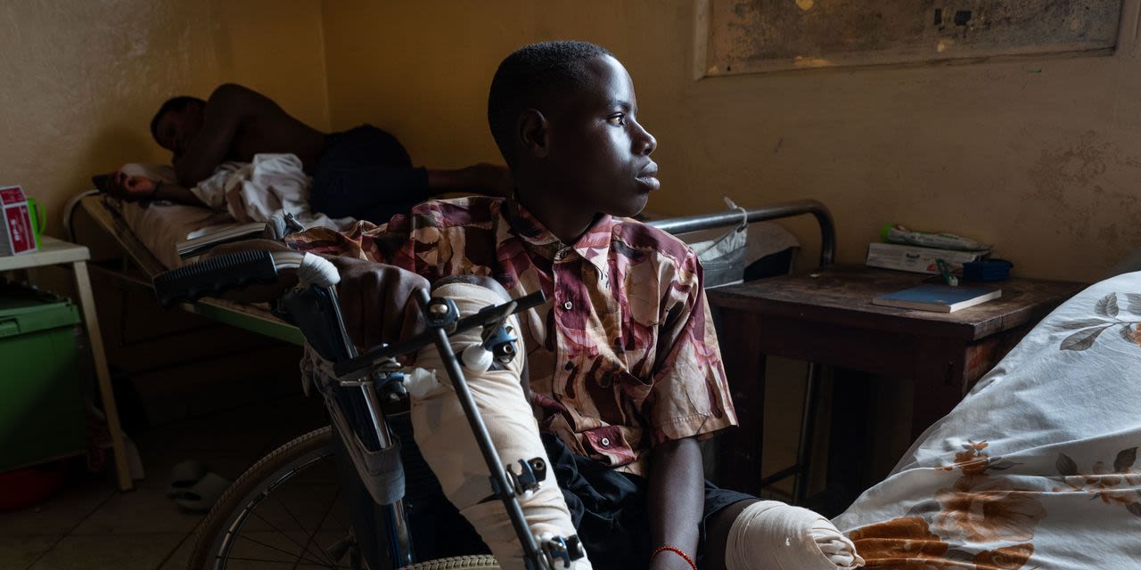 Kidnapped by One Side, Maimed by the Other: A Teenager’s Ordeal in Congo’s 30-Year War