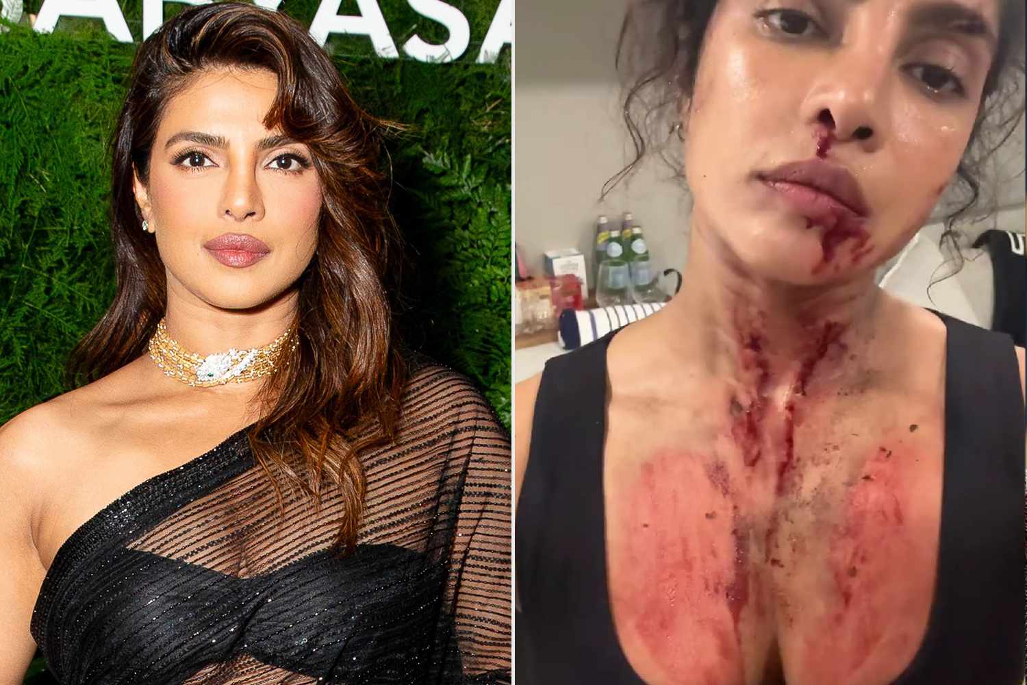 Priyanka Chopra Ditches Glam in Bloody Behind-the-Scenes Look at Action Movie: 'Another Day at the Office'
