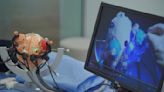 Research team develops MRI-guided multi-stage robotic positioner for precise stereotactic neurosurgery